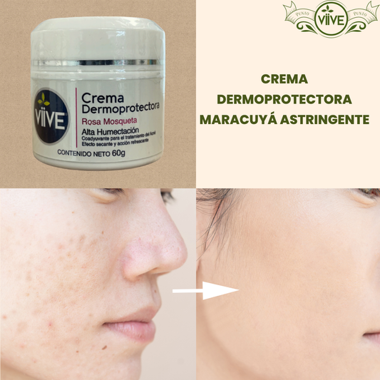 CREMA DERMO PROTECTORA ROSA MOSQUETA 60 G